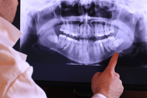 Best Emergency Dental Care for Abscessed Tooth in Sharpsburg, NC