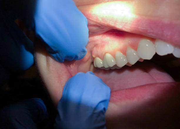 Best Pediatric Emergency Dentist in Sharpsburg, NC