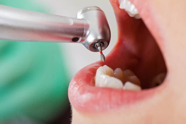 Best Orthodontic Emergency Dentist in Sharpsburg, NC